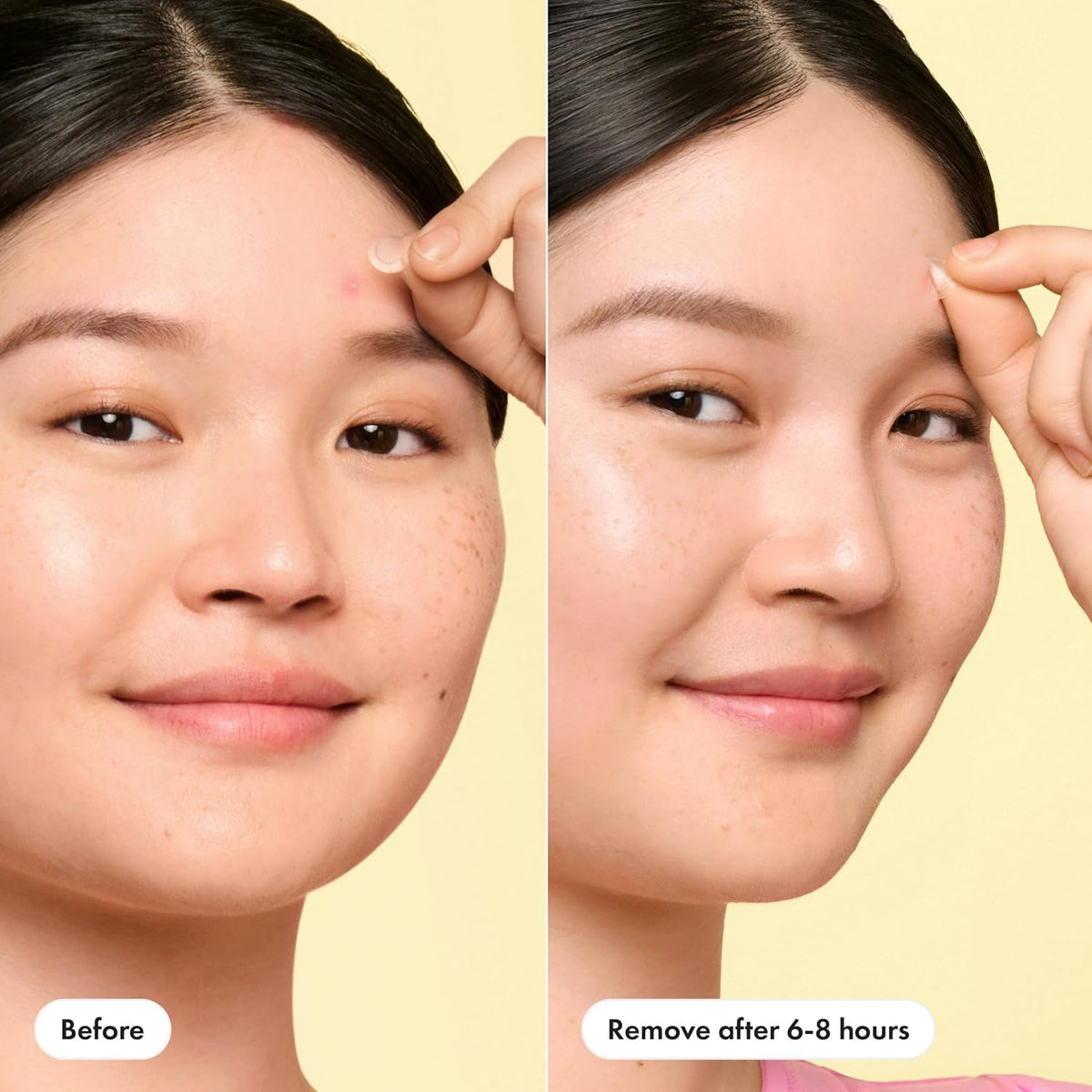 Hero Cosmetics  Mini Invisible+ Acne Pimple Patches, 30 Ct | X-Small 10Mm, Daytime Hydrocolloid Acne Patches, for Covering Zits & Blemishes, Blends into Skin & Barely There