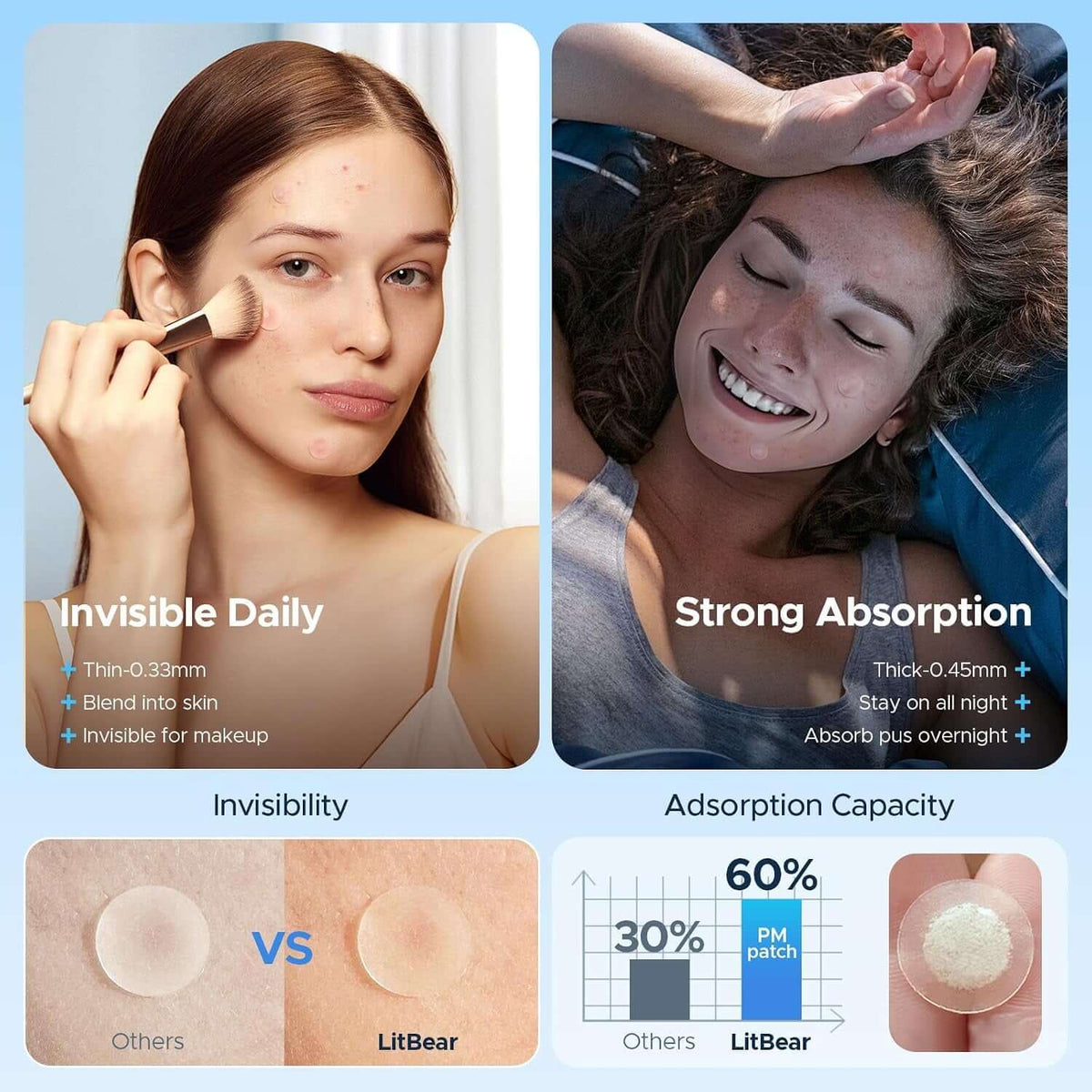 Pimple Patches for Face, 5 Sizes 400 Counts Hydrocolloid Acne Patch, Day & Night Spot Stickers Variety Pack, Thin & Thick for Covering Zits, Pimples, Large Breakouts, Chin, Forehead