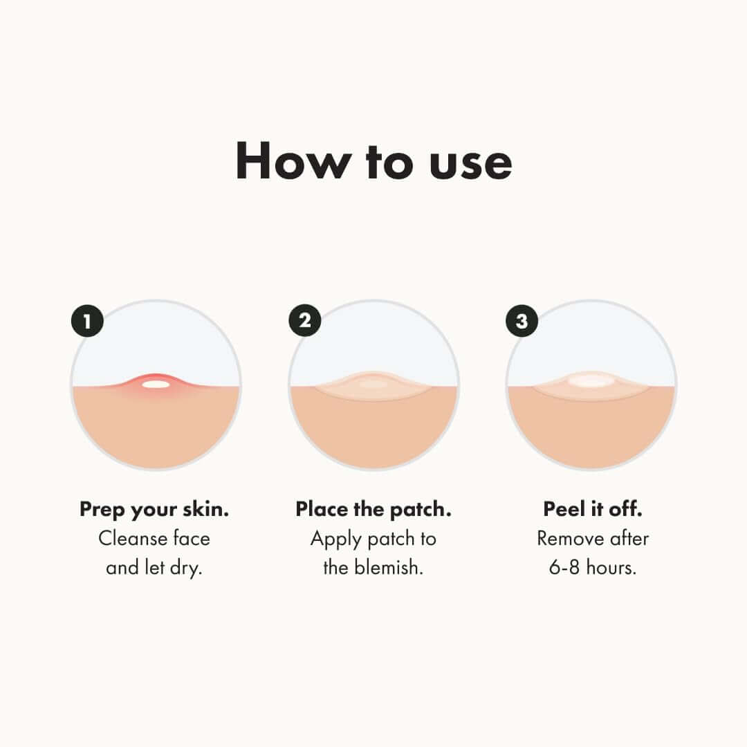 Hero Cosmetics Day and Night Acne Pimple Patches, 36 Ct | 18X Original + 18X Invisible+ Patches, Absorbs Pimple Gunk in 6-8 Hours, Medical-Grade Hydrocolloid, Dermatologist-Tested