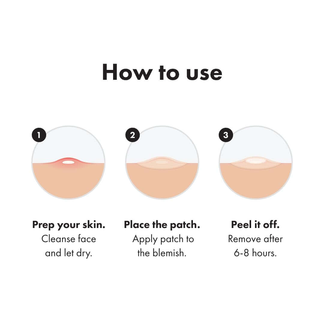 Hero Cosmetics  Invisible+ Daytime Acne Pimple Patch, 72 Ct | Barely-There Hydrocolloid Patch for Covering Zits and Blemishes, Tapered Edges Designed to Blend into Skin