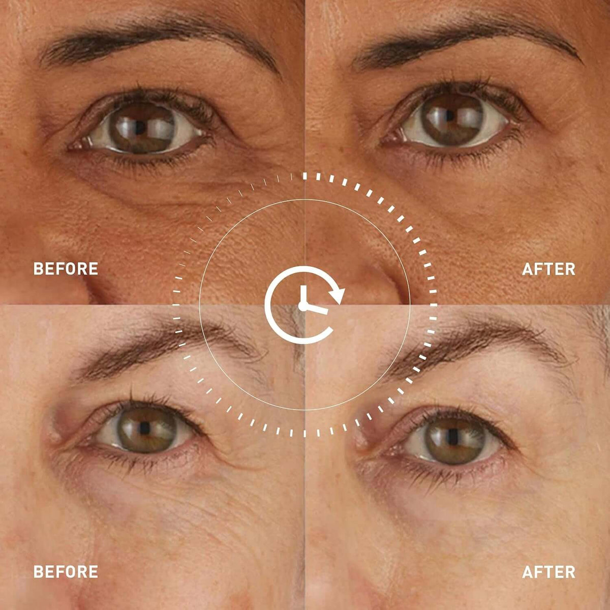 Hydro Cool Firming Eye Patches with Peptides and Coenzyme Q10 | 10-Minute No-Slip Eye Mask for Dark Circles, Puffy Eyes, under Eye Bags, Fine Lines & Wrinkles, Fragrance-Free