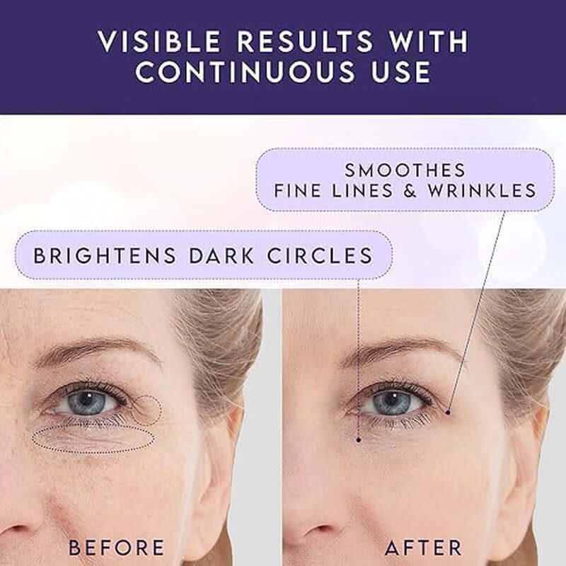 Retinol Eye Stick & Caffeine under Eye Brightener – under Eye Balm Stick for Dark Circles, Puffiness, Eye Bags, Wrinkles & Fine Lines, Cooling under Eye Stick, 2 Pack
