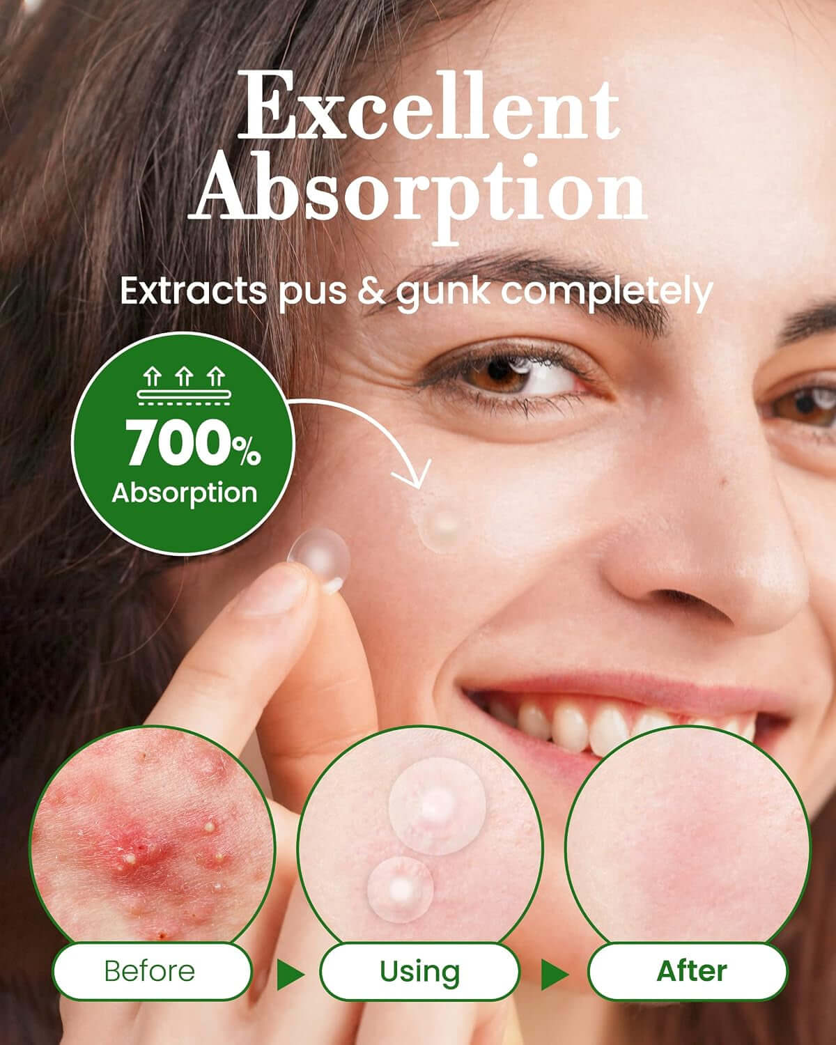 Invisible Pimple Spot Patch - 96 Ultra Thin Acne Patches - Easy Peel - 2 Sizes