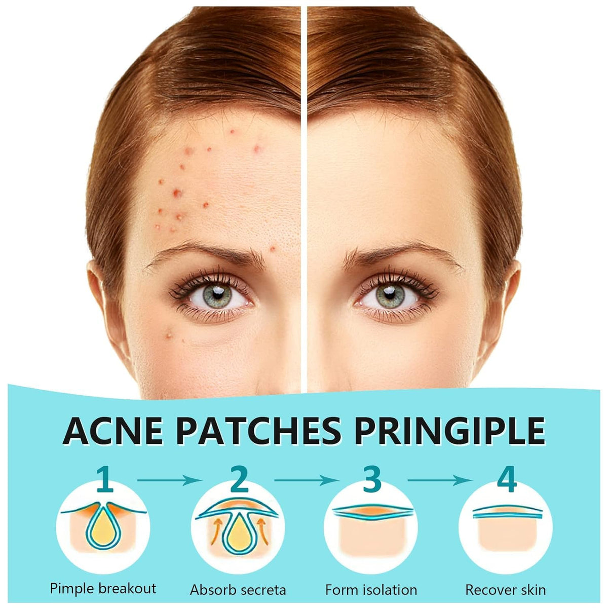 720 Counts Pimple Patches for Face Hydrocolloid Acne Patches for Face Invisible Zit Patches Pimple Patch Acne Spot Treatment Patch Blemish Patches Cover Patches Stickers